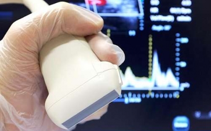 Renkli Doppler İncelemeler